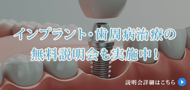 インプラント・歯周病治療の無料説明会も実施中！